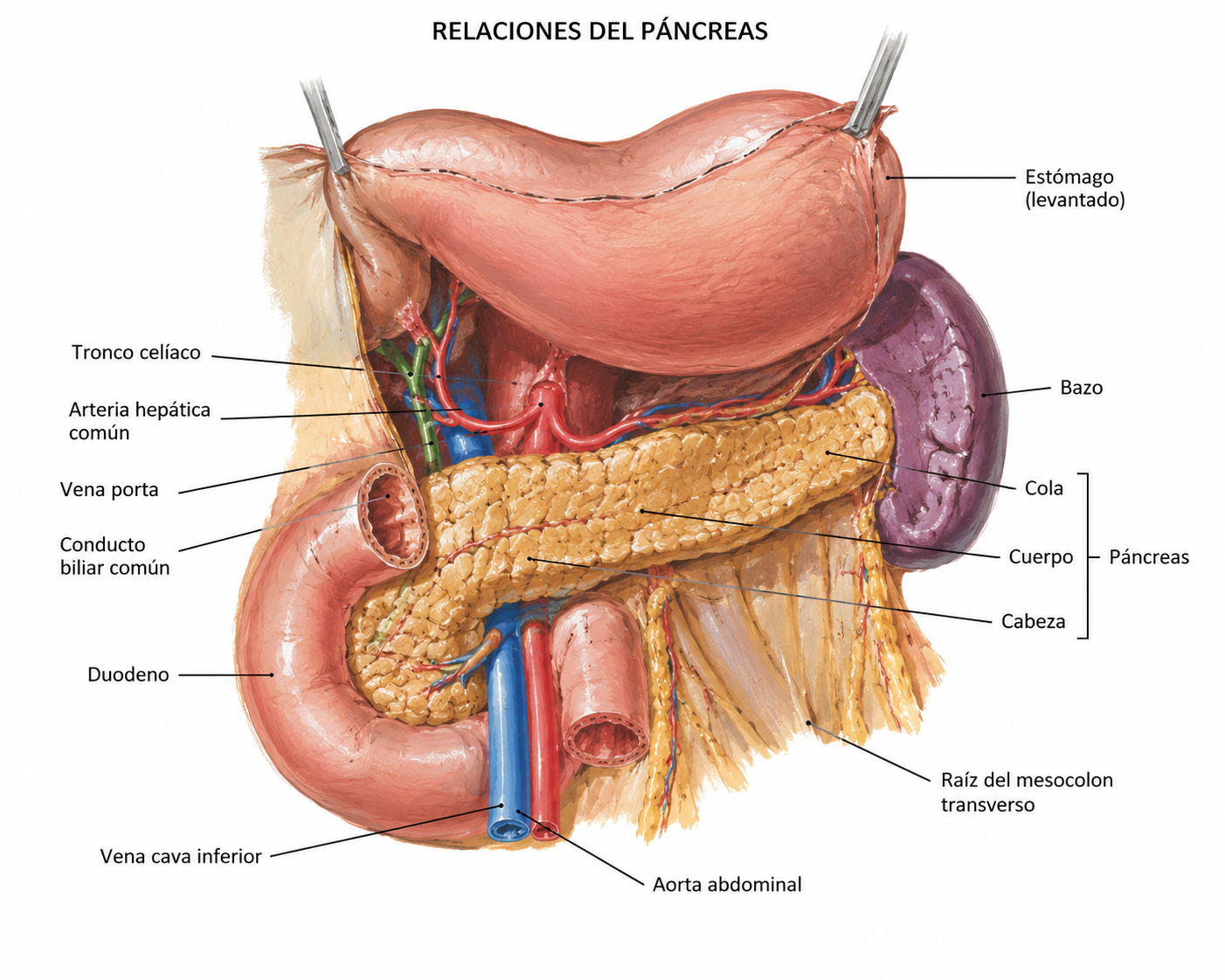 Cáncer de páncreas