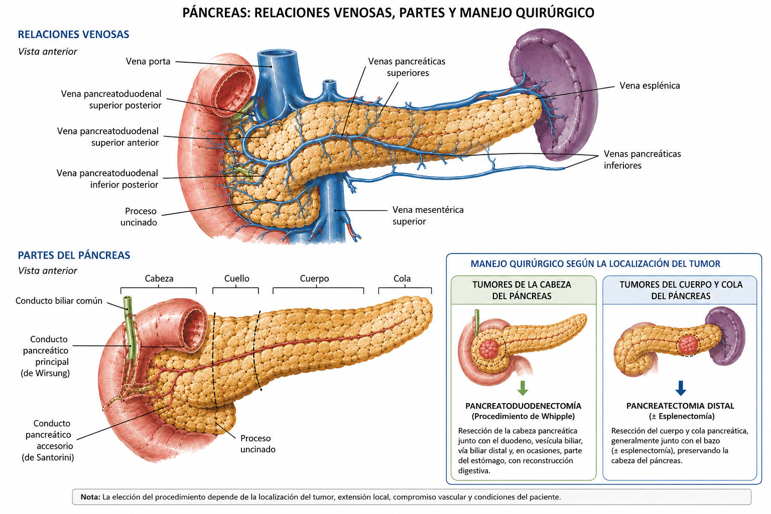 Diagnóstico de cáncer de páncreas